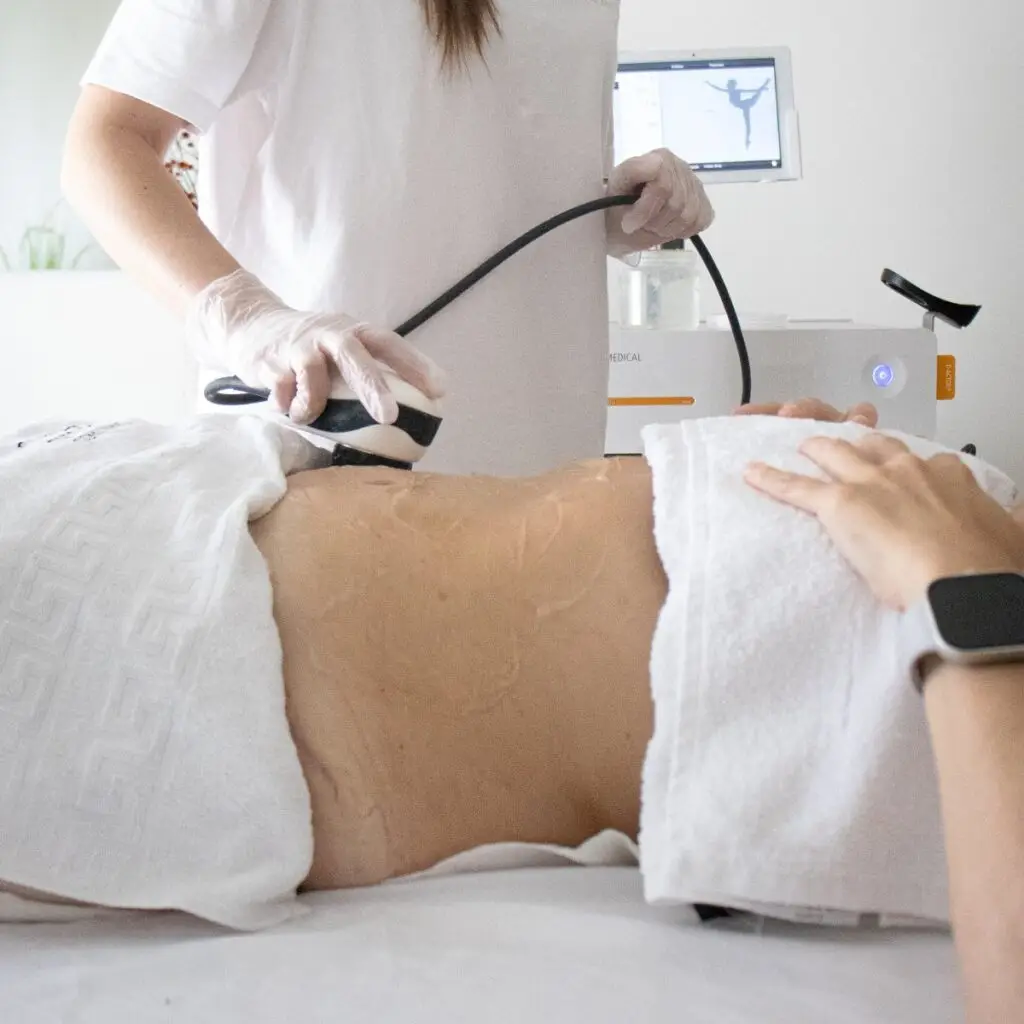 Tratamento de endermologia com equipamento LPG Cellu M6 Alliance
